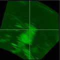 RBM 20 nmi Expanded range scale